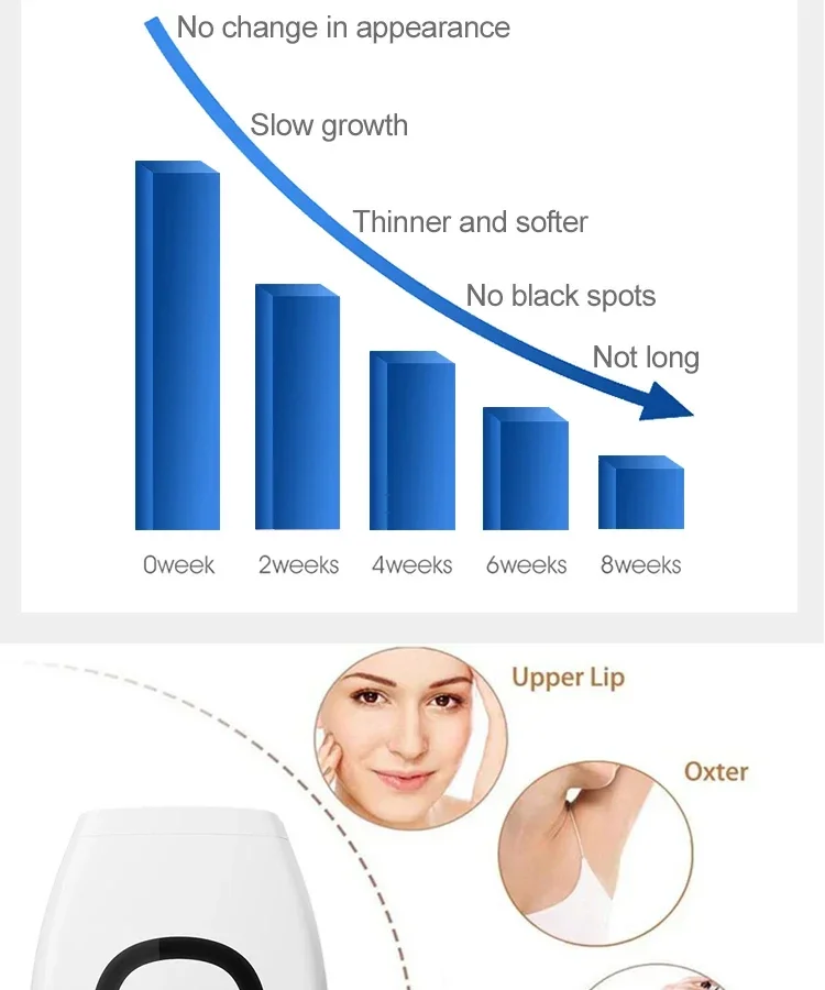 990000 Flashes IPL Laser Hair Removal Device for Women Painless Permanent Hair Remover for Body Bikini and Face Home Use