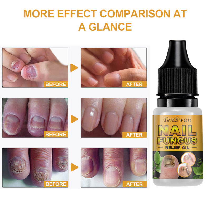 Nail Brightening Moisturizing Solution